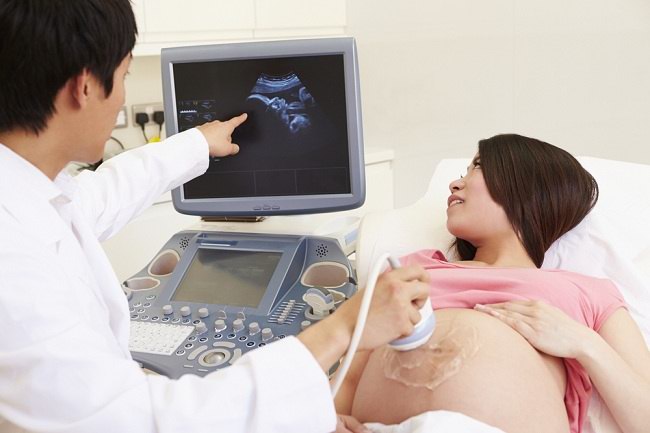 Setiap Orang Tua Pasti Kaget, Menikah Baru 2 Minggu Tapi Tapi Kata Dokter Sudah Hamil 1 Bulan, Ini Penjelasannya Setiap Orang Tua Pasti Kaget, Menikah Baru 2 Minggu Tapi Tapi Kata Dokter Sudah Hamil 1 Bulan, Ini Penjelasannya