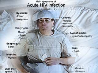 Hidup Mesti Diteruskan Tanda Tanda Anda Dijangkiti Hiv