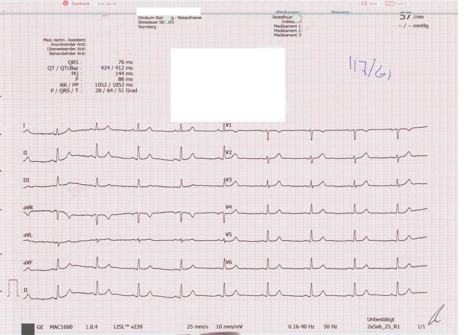 News Klinische Notfall und Akutmedizin Fancy EKG Eine Patientin mit Synkope