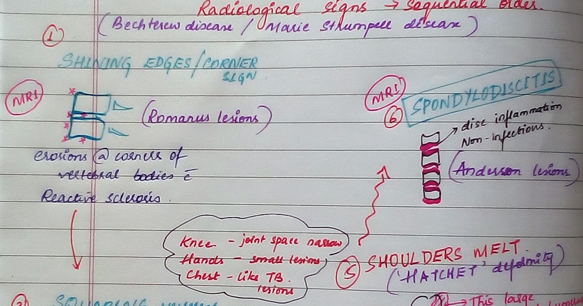 Medicowesome: Submissions: Ankylosing Spondylitis (Radiological signs ...