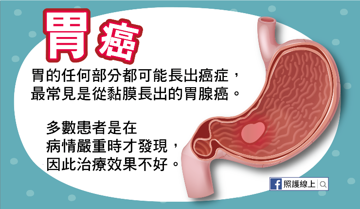 胃癌可發生在胃裡頭的任何位置，也有不同形態
