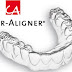 Kỹ thuật niềng răng 3d clear aligner