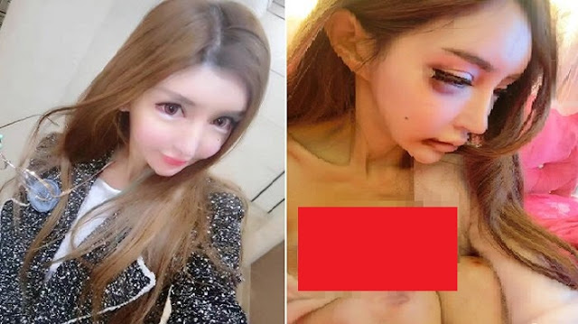 Pria Ini Pecahkan Pay*dara Pacar Hasil Oplas. Alasannya Sepele Pria Ini Pecahkan Pay*dara Pacar Hasil Oplas. Alasannya Sepele