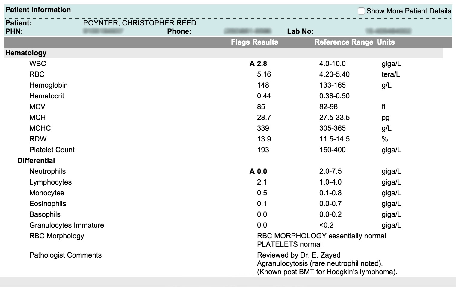 Positive Leukemia Blood Test Results