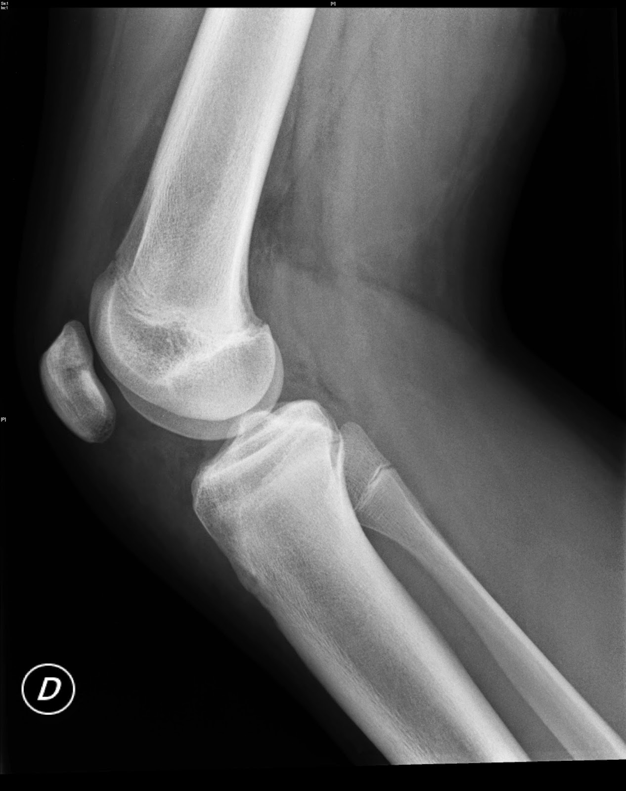 Docencia Alto Palancia Rótula Bipartita.IMAGEN DOCENTE.