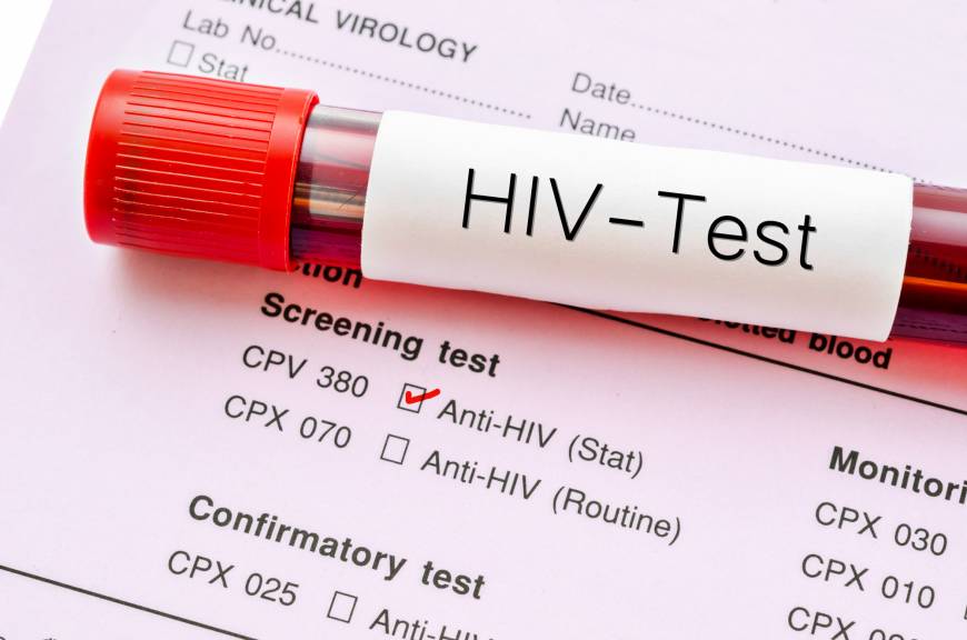 Visual Anthropology of Japan 日本映像人類学 "Japan to offer free HIV