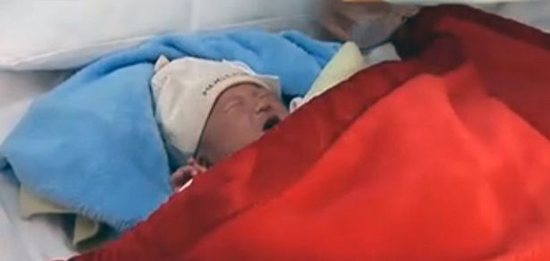 doctors cut baby face c section china