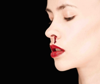 Bloody Nose Causes and How to Stop a Bloody Nose | The Celebrity Nose