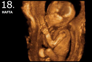 18 hafta ultrason resmi