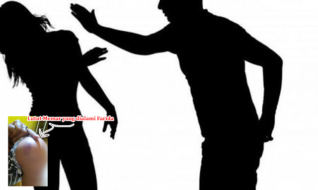 Aniaya Dianiaya Adik Ipar, Ibu Muda Lapor Polisi