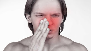 Obat Penyakit Sinusitis Obat Penyakit Sinusitis