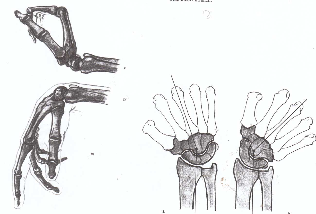 Конструктивное построение кисти руки. Кинематика человеческой ладони. Кисти рук для рисования. Су джок схема ладони. Мышцы сгибатели руки в плечевом суставе.