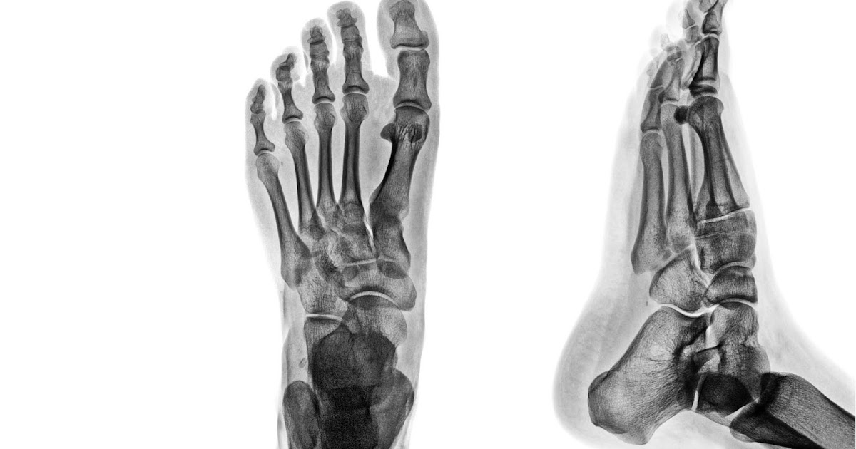 Ankle & Foot Diagnostic Imaging Arthritis & Trauma II El Paso, TX.