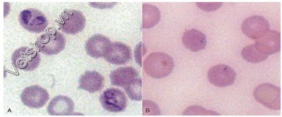 Hình 4. Bệnh tích vi thể phân biệt B. canis (A) và B. gibsoni (B)