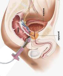 NUOVO SERVIZIO: RIABILITAZIONE PAVIMENTO PELVICO - San Donato Medica - Foto 5