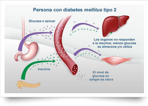 Nivel de glucosa en sangre en cetosis