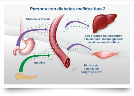 Como bajar la glucosa en sangre