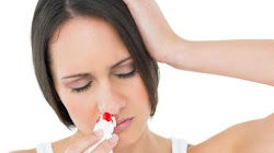 Một số phương pháp điều trị viêm mũi dị ứng
