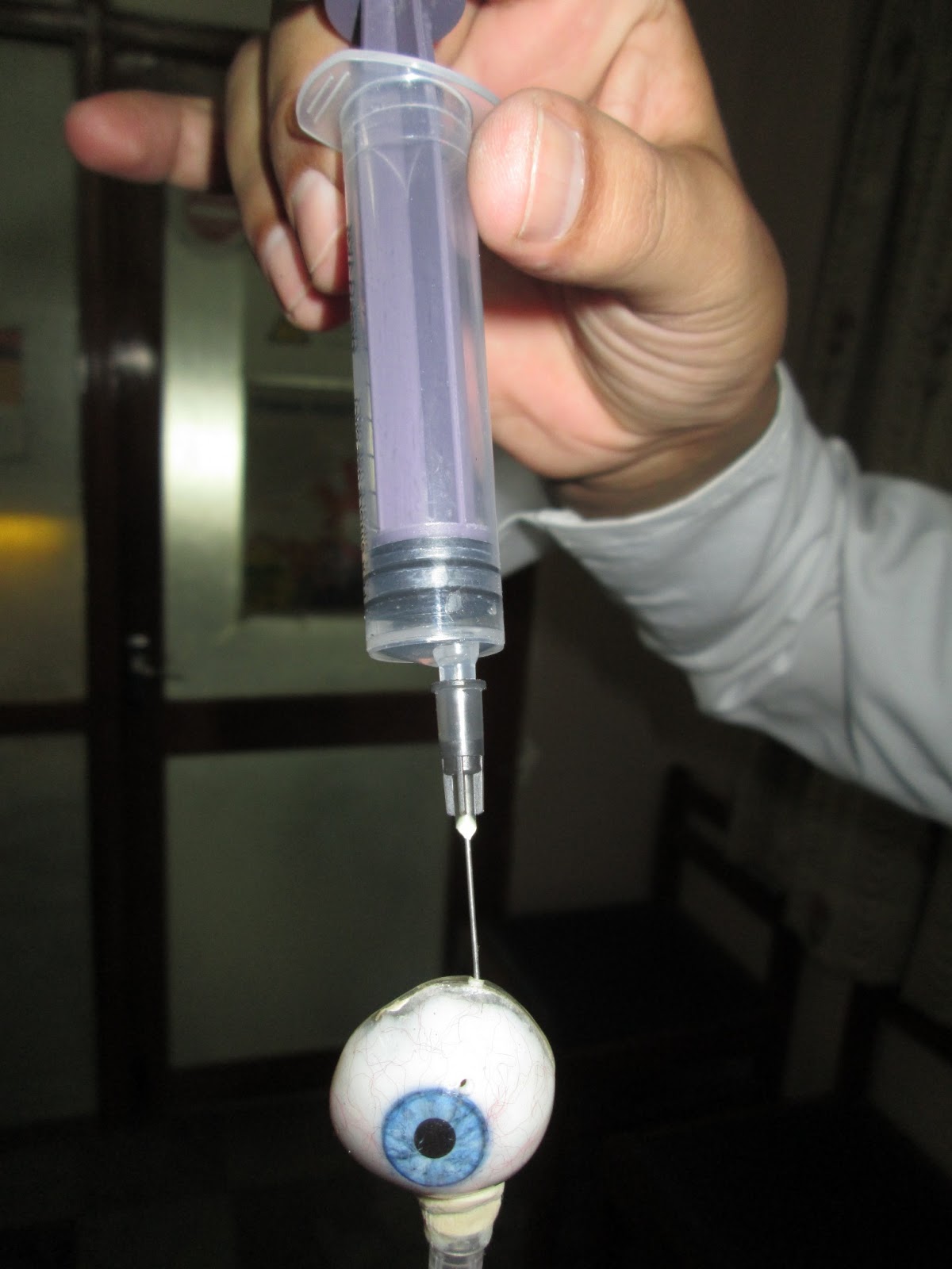 SelfLubricating Ocular Prosthesis Kolkata, West Bengal Self