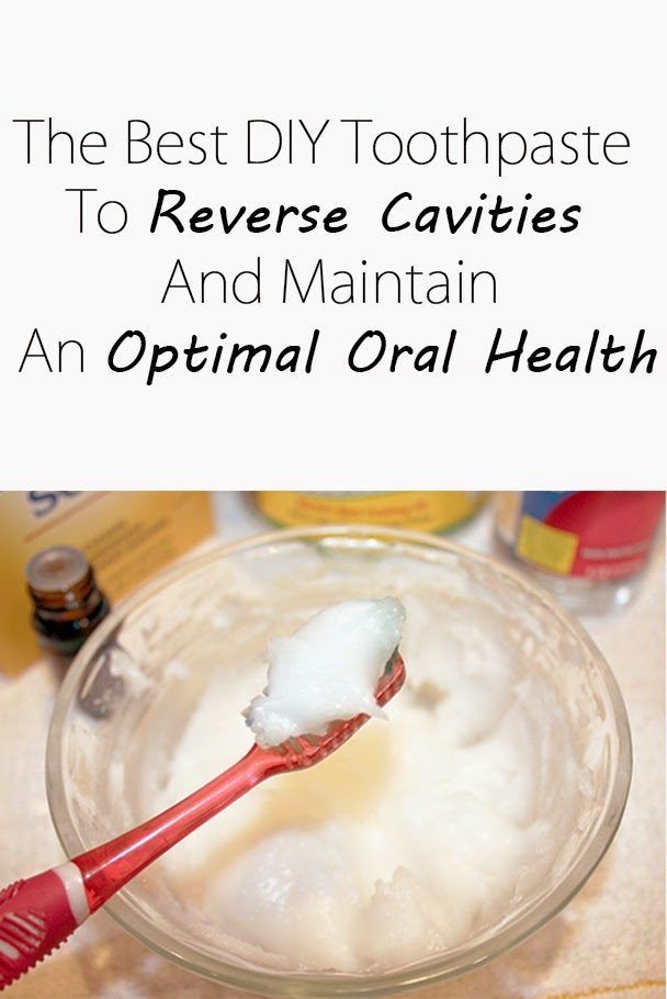 The Best DIY Toothpaste To Reverse Cavities and Maintain An Optimal