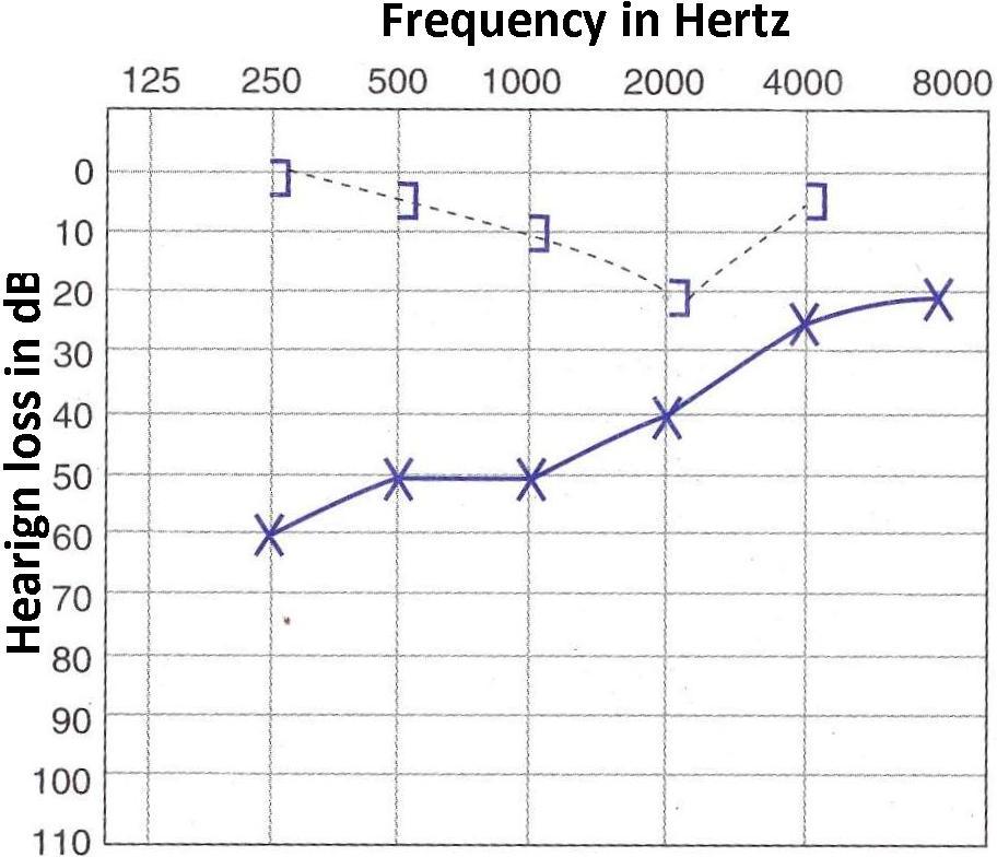MBBS DOCTORS OTOSCLEROSIS