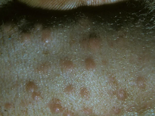 goat pox, goat pox disease, goat pox pictures