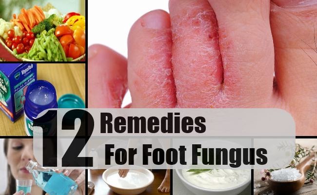 Hollywood pictures full hd movies free download 2020 Home remedy for foot fungal infection