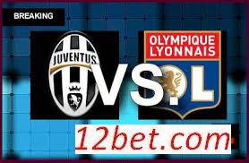 Kèo cá độ miễn phí Juventus vs Lyon (02h45 ngày 3/11/2016) Juventus1