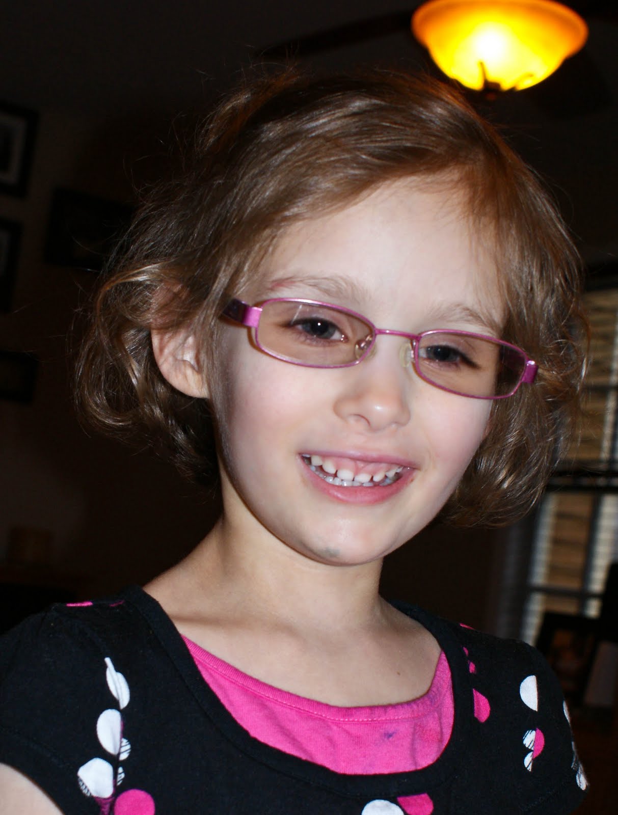 Mixed Nuts Lebers Congenital Amaurosis (LCA) and RDH12