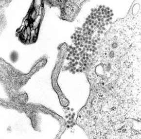 gambaran dari mikroskop TEM yang menunjukkan virion virus Dengue, mikrobiologi, infeksi tropik, demam berdarah dengue, dengue syok sindrom, dengue shock syndrome, praktikum laboratorium, praktikum kedokteran laboratorium, plasma darah, mikroskop elektron