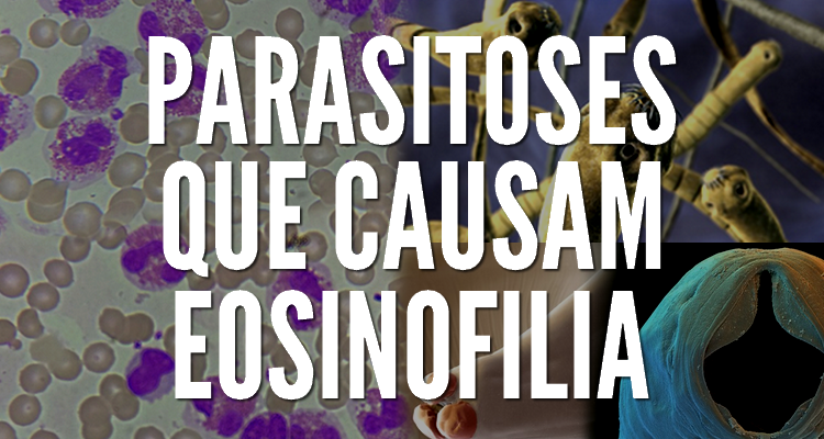 eozinofil paraziták)