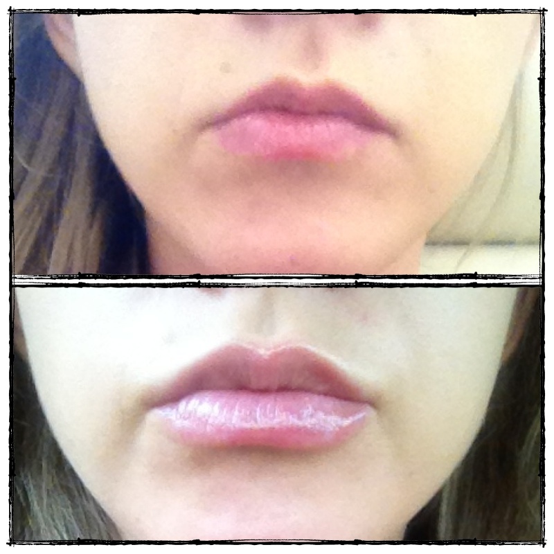 Фитоджен Regenyal idea lips результат