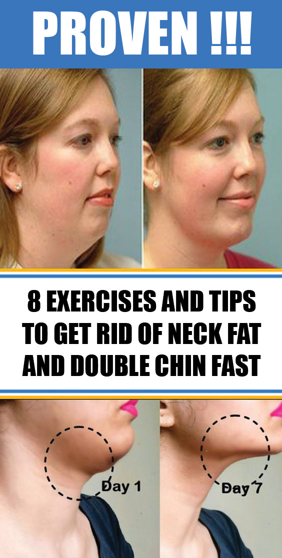 8 Exercises And Tips To Get Rid Of Neck Fat And Double Chin Fast 