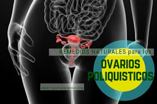 Remedios caseros para los ovarios poliquisticos