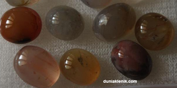 Jenis-jenis Batu Akik, Makna dan Kegunaannya Menurut Primbon duniaklenik.com
