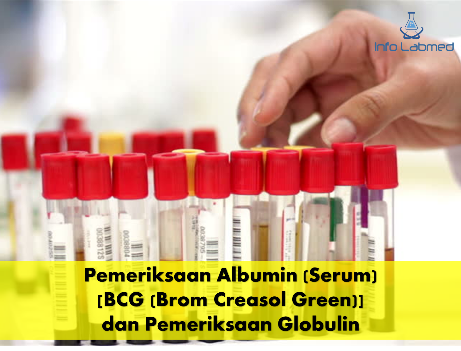 Pemeriksaan Albumin (Serum) [BCG (Brom Creasol Green)] dan Pemeriksaan