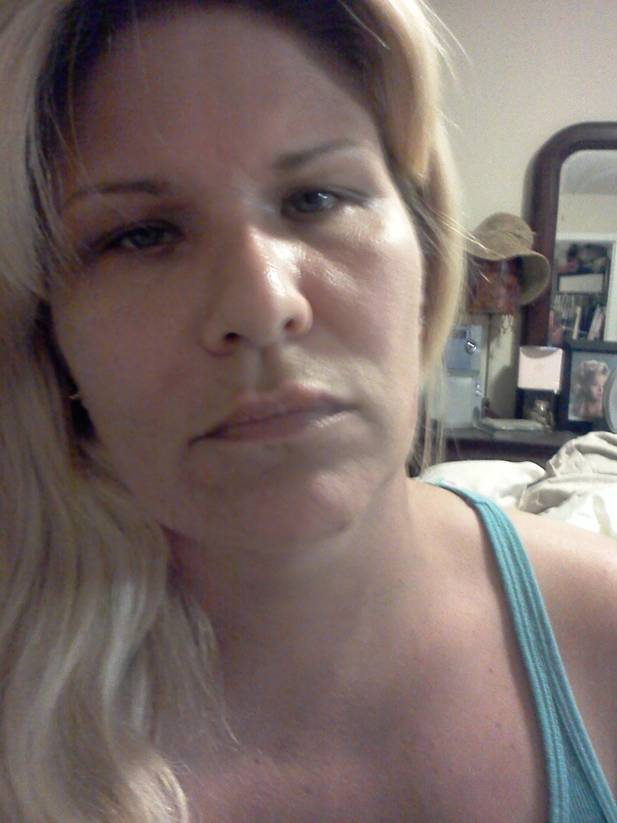 Life with Lupus: Symptoms from mild to severe. These are just a few.