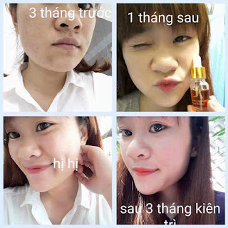 serum Kiều beauty queen serum Kiều beauty queen