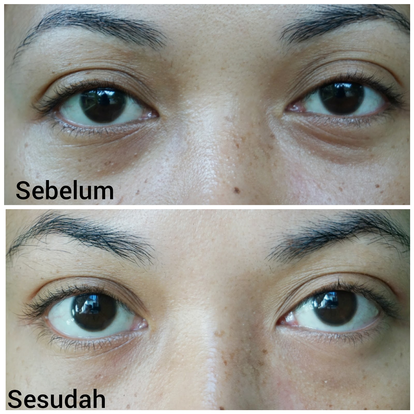 review avoskin eye serum
