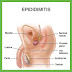 PENYAKIT EPIDIDIMITIS
