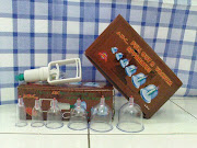 Set Peralatan Bekam