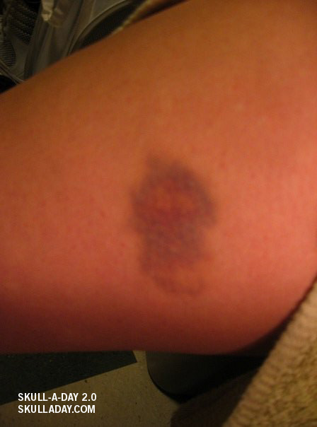 [submission313d.jpg]