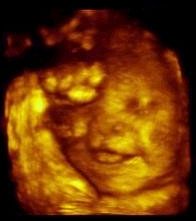 [smiling_unborn_40_weeks.jpg]