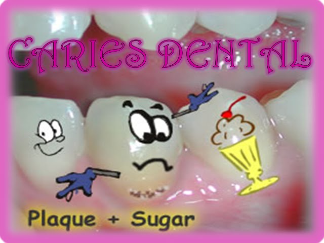 Caries Dental...!