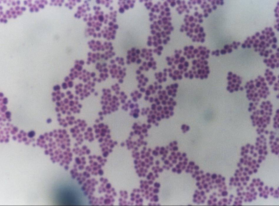 How You Consist of Trillions of Tiny Machines Tim Flannery Microbiology, Microsc