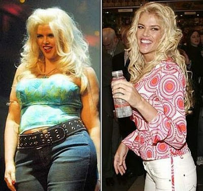 El Antes y Despues de la Estrellas - Anna Nicole Smith