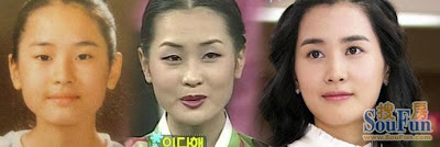 hey hey hey: [ Lee Da Hae ] Before & After Plastic Surgery