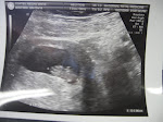 Baby Coates