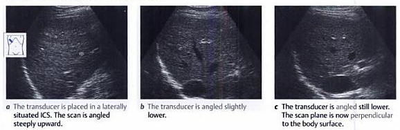 Interpostal Scanning Ultrasound : Liver - Technique