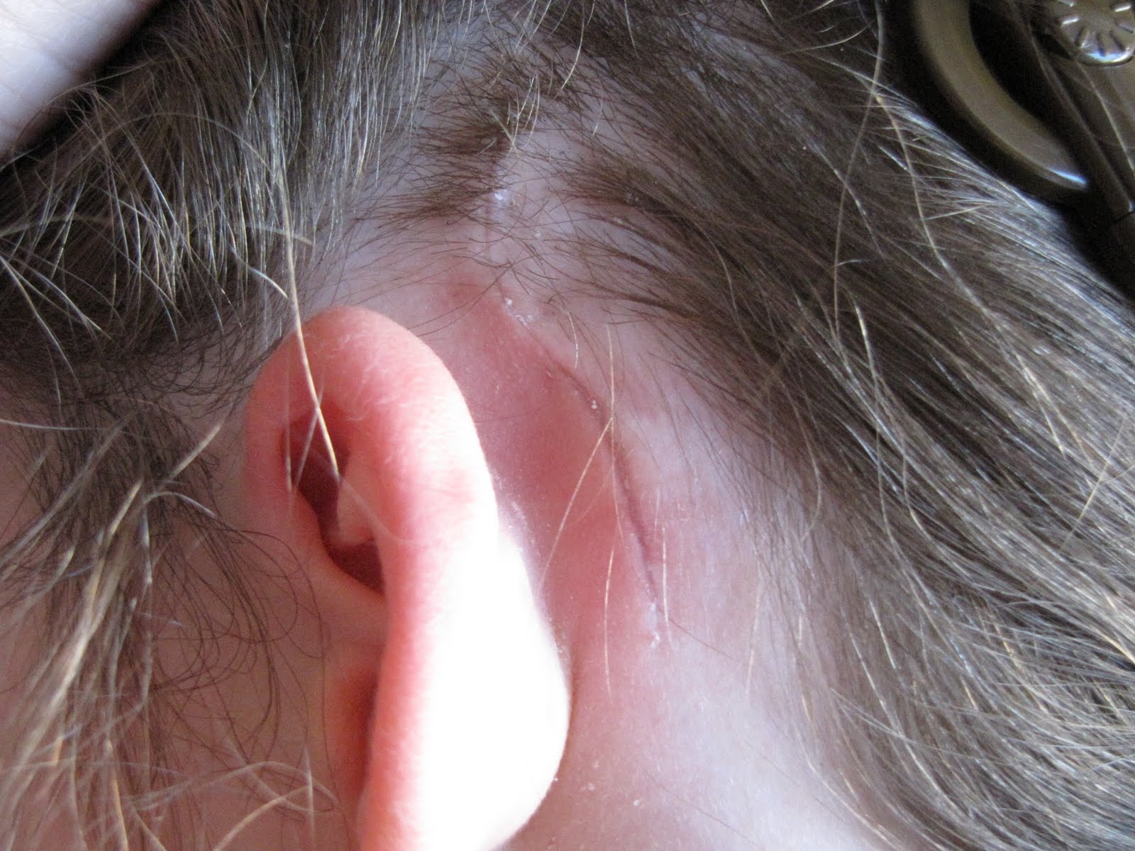 Hearing Mother, Deaf Daughter